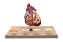 Load image into Gallery viewer, Heart: Heart Condition Model