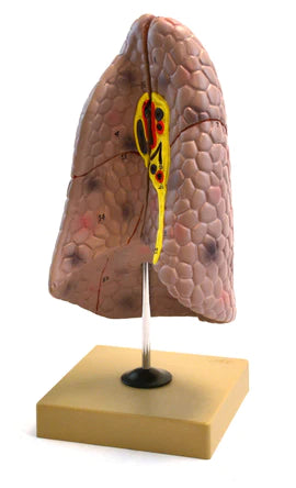 Eisco Human Right Lung Model